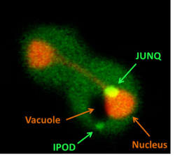 ,  JUNQ  IPOD. Nucleus   , vacuole  
